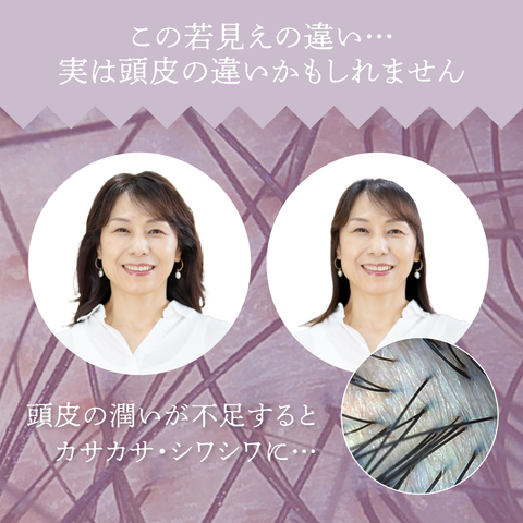 REDENICAL EX MEDICATED SHAMPOO WOMEN REFILL